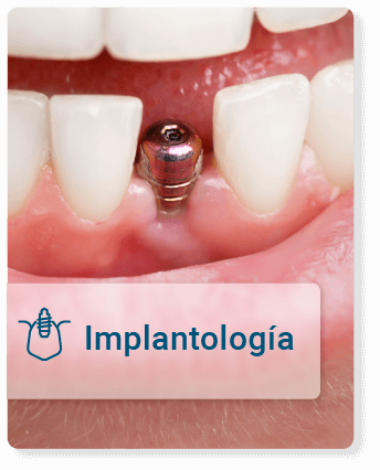 Implantología