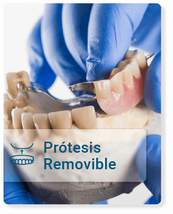 Prótesis-Removible